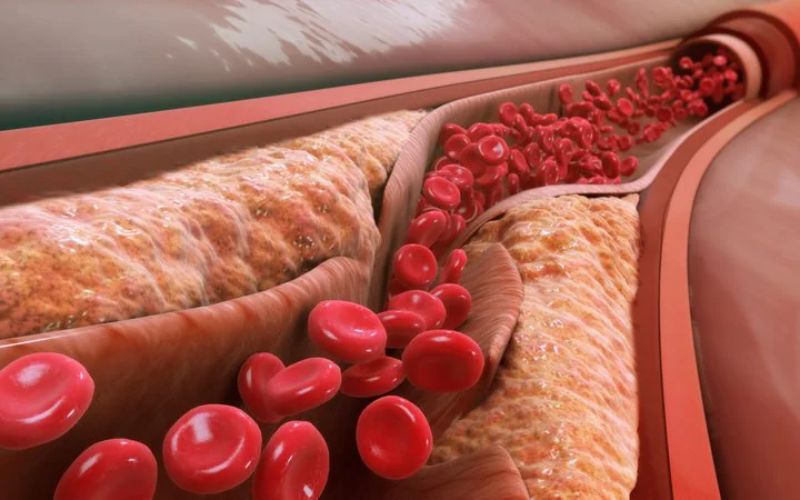 Kiểm soát nồng độ cholesterol trong máu